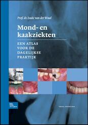 Mond- en kaakziekten - Isaac van der Waal, I. van der Waal (ISBN 9789031386093)
