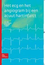 Het ECG en het angiogram bij een acuut hartinfarct