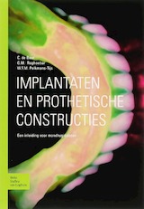 Implantaten en prothetische constructies
