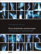Musculoskeletale aandoeningen - Johan Bellemans, Jan Victor (ISBN 9789463443890)