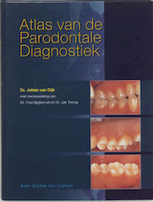 Atlas van de parodontale diagnostiek - J. van Dijk (ISBN 9789031332960)