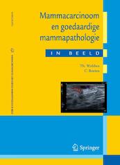 Mammacarcinoom en goedaardige mammapathologie in beeld - Th Wobbes, C. Boetes (ISBN 9789031385355)