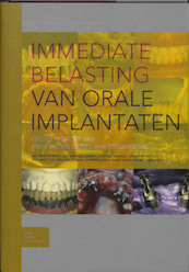 Immediate belasting van orale implantaten - (ISBN 9789031351749)