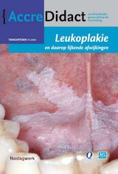 Leukoplakie en daarop lijkende afwijkingen - Isaäc van der Waal (ISBN 9789089762061)