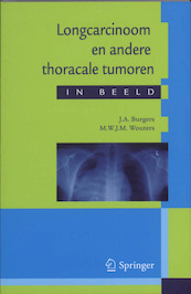 Longcarcinoom en andere thoracale tumoren in beeld - J.A. Burgers, M. Wouters (ISBN 9789031362615)