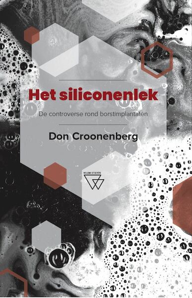 Het siliconenlek - Don Croonenberg (ISBN 9789492419439)