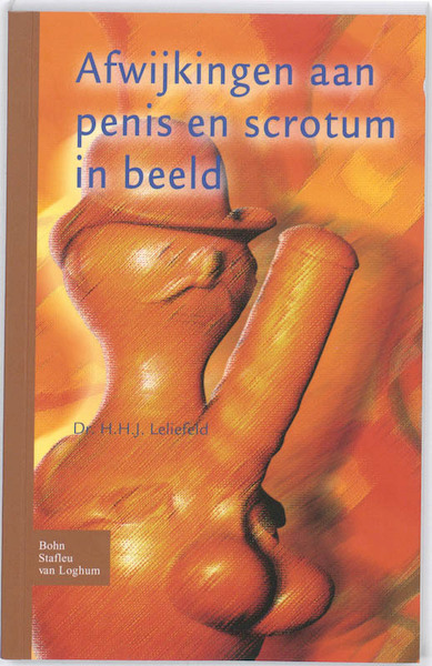 Afwijkingen aan penis en scrotum in beeld - Leliefeld (ISBN 9789031352920)
