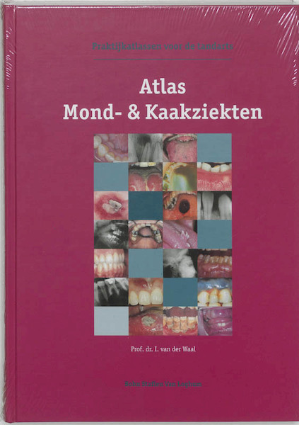 Atlas mond- & kaakziekten - I. van der Waal (ISBN 9789031337484)
