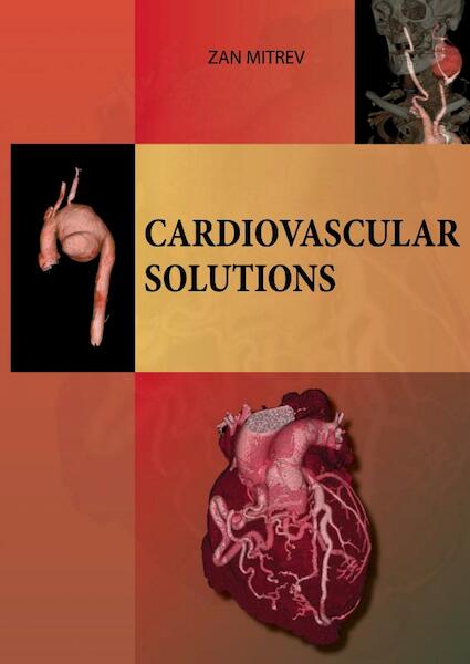 Cardiovascular Solutions - Zan Mitrev (ISBN 9789463675734)