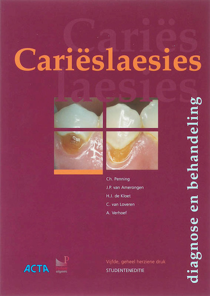 Carieslaesies Studenteneditie - Ch. Penning (ISBN 9789085620464)