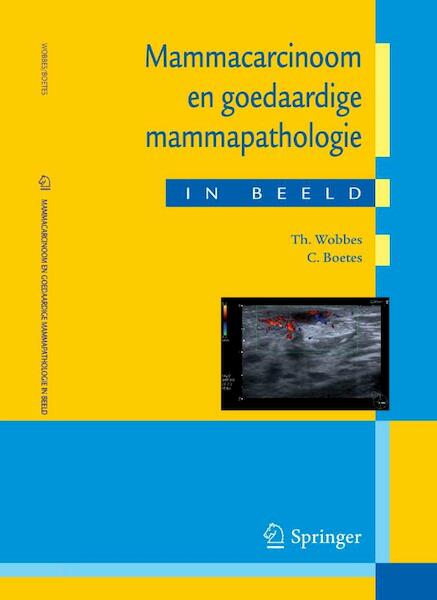 Mammacarcinoom en goedaardige mammapathologie in beeld - T. Wobbes, C. Boetes (ISBN 9789031362622)