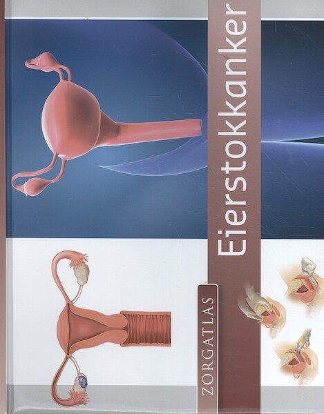 Zorgatlas Eierstokkanker - Arnold Krüse, Wim Van der Steeg, Bernadette Rigterink, Roelien Schaapman (ISBN 9789491984488)