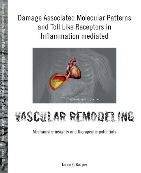 Damage associated molecular patterns and toll like receptors in inflammation mediated vascular remodeling - Jacco Karper (ISBN 9789088917974)