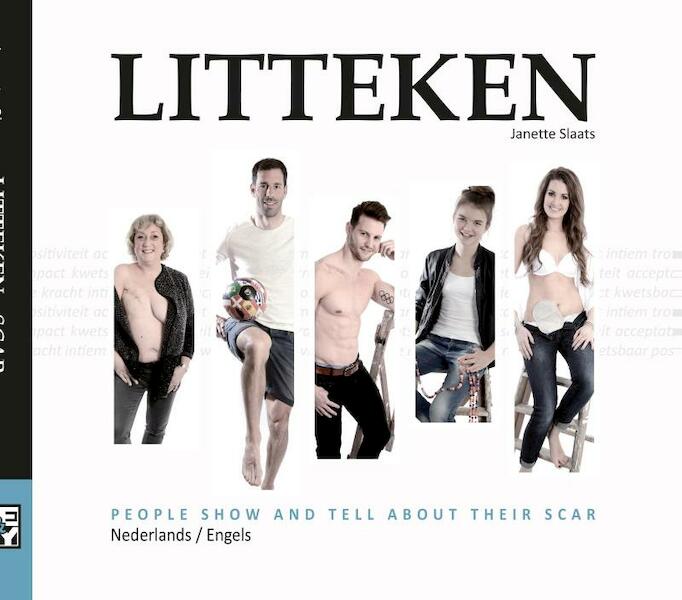 Me&my litteken - Janette Slaats (ISBN 9789082532302)